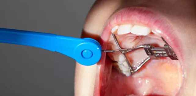 Damak Darlığı Nedir?